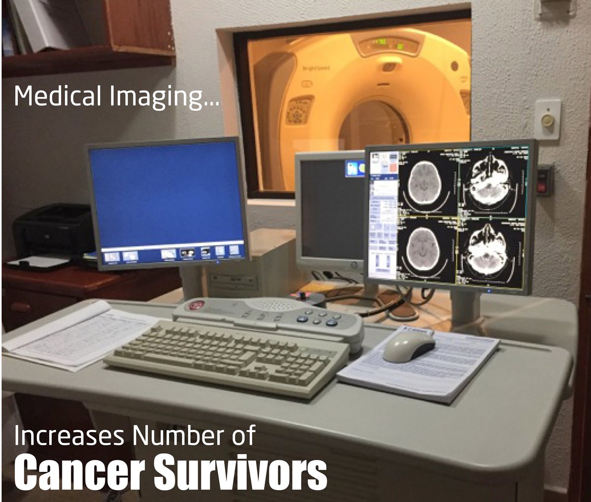 Medical Imaging Increases Number of Cancer Survivors